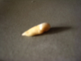 用戶插入圖案